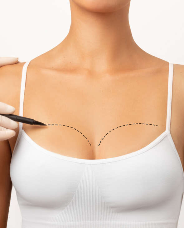 Breast Surgery