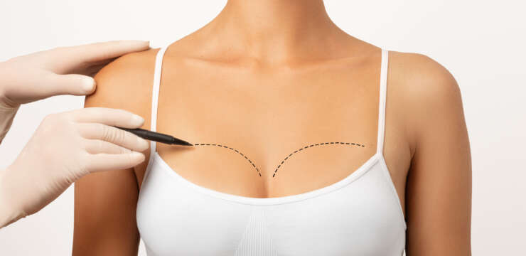 Breast Surgery