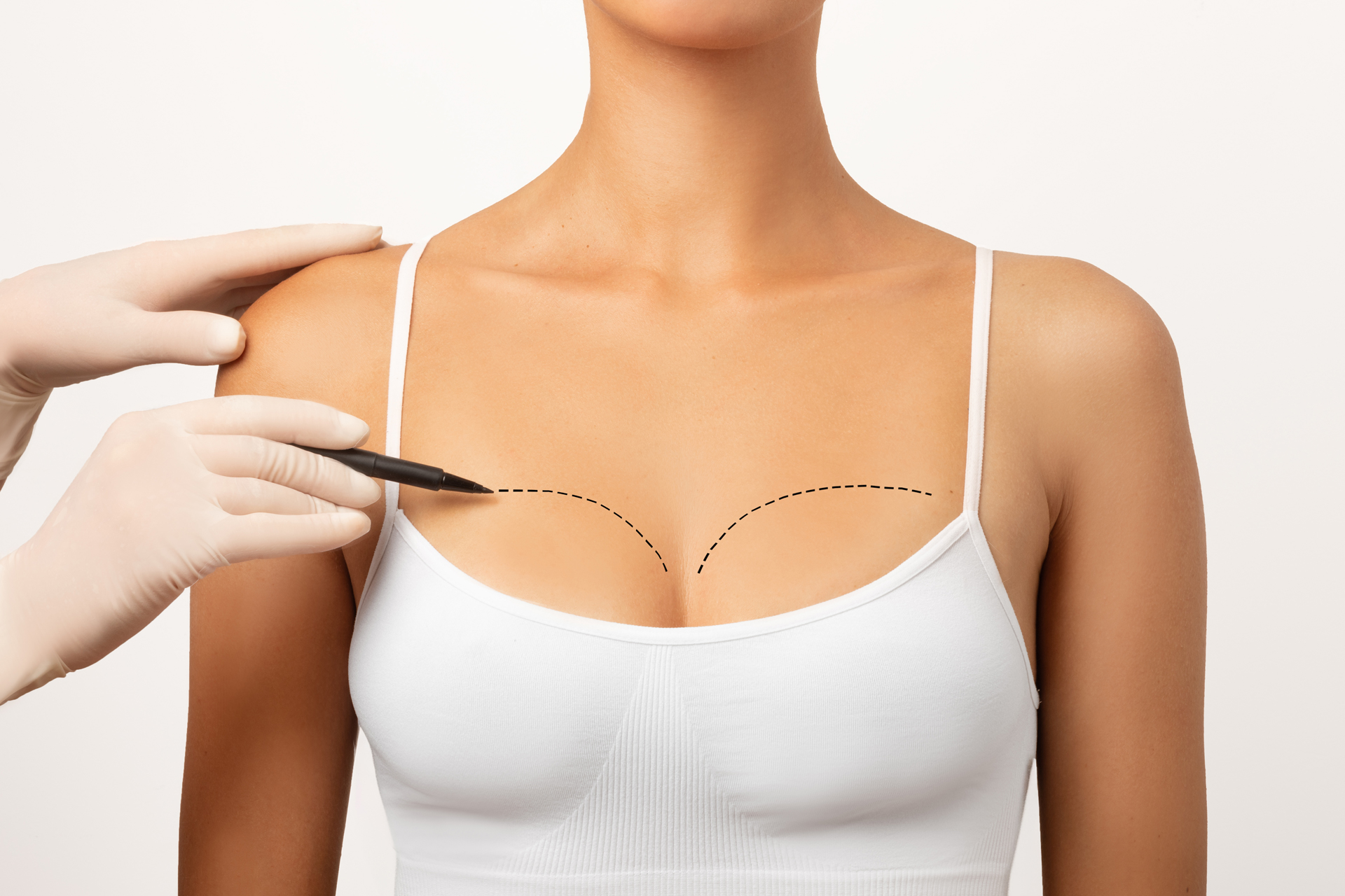 Breast Surgery